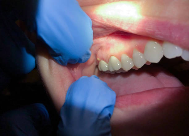 Best Broken Tooth Emergency  in Rehobeth, AL