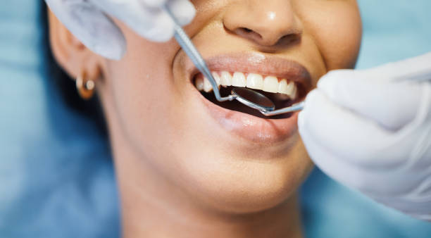Best Cracked Tooth Emergency Dentist  in Rehobeth, AL
