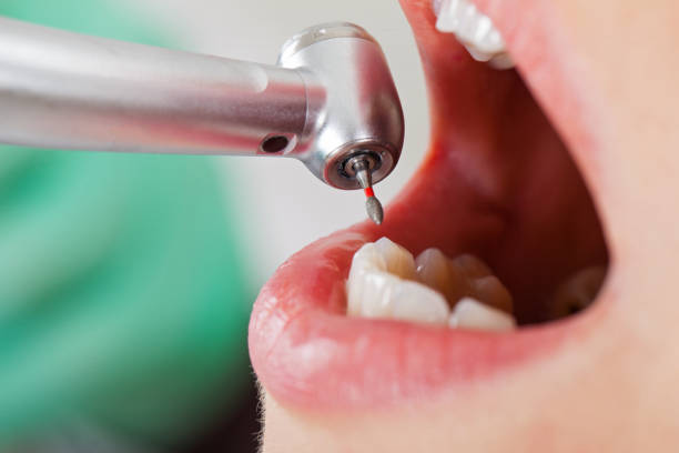 Best Knocked-Out Tooth Emergency  in Rehobeth, AL